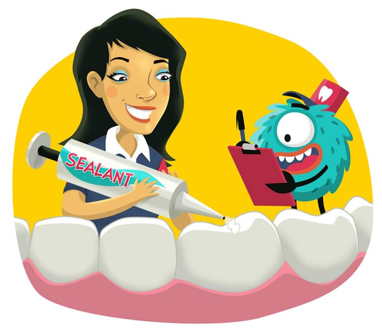 Dental Sealants for Kids and Teens in New York City